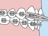 Losoe Wire