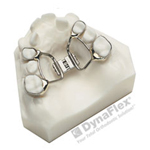 Palatal Expander - Types of Appliances