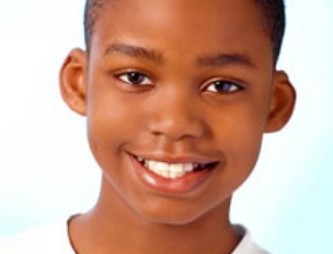 Invisalign