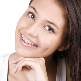 Why Braces?