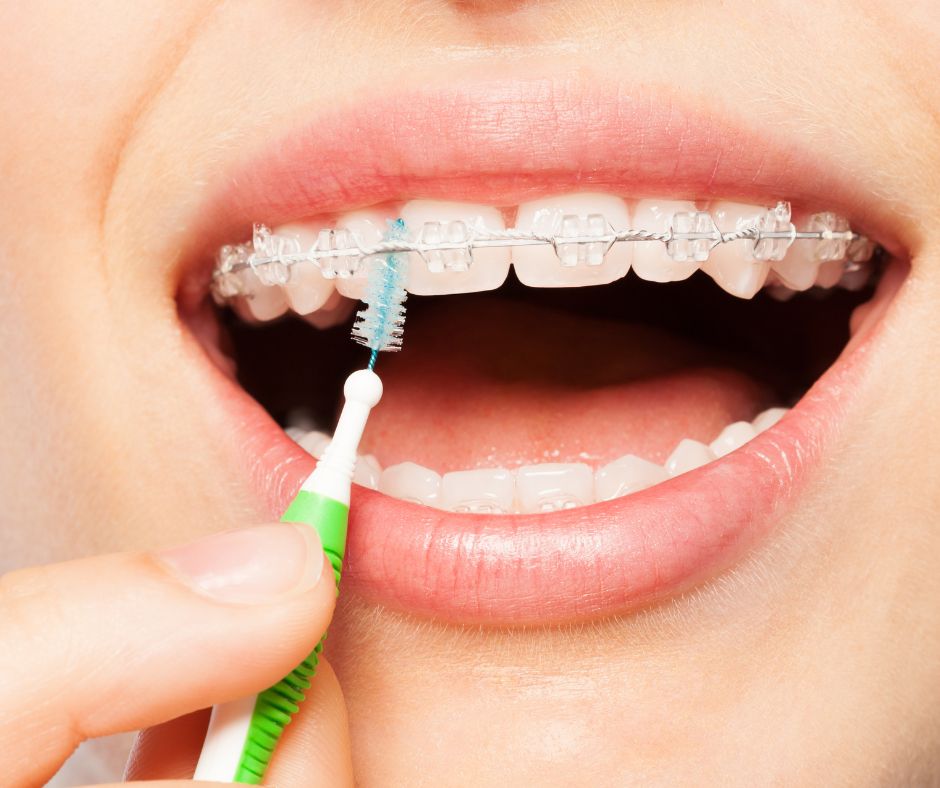 Braces in Eugene, Corvallis & Albany, OR Paventy & Brown Orthodontics